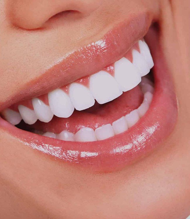 Close de lentes de contato dental