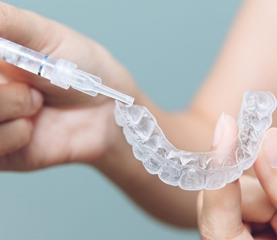 Moldeira transparente de clareamento caseiro recebendo o gel clareador