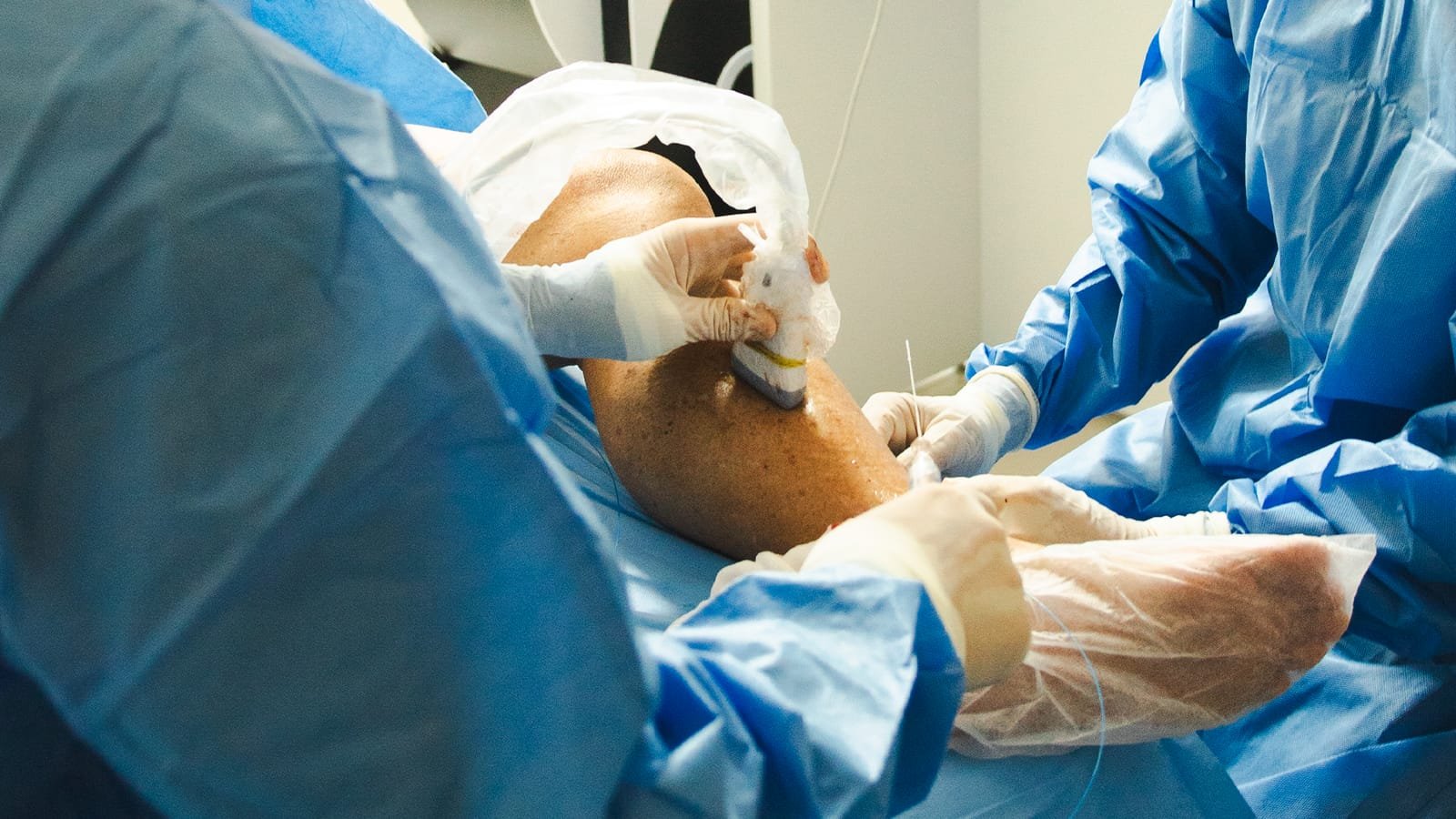 Procedimento vascular minimamente invasivo na perna