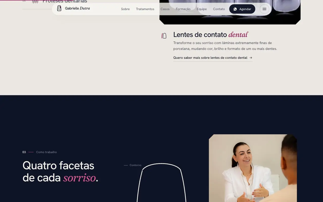 Lentes de contato dental, Dra. Gabrielle Dutra