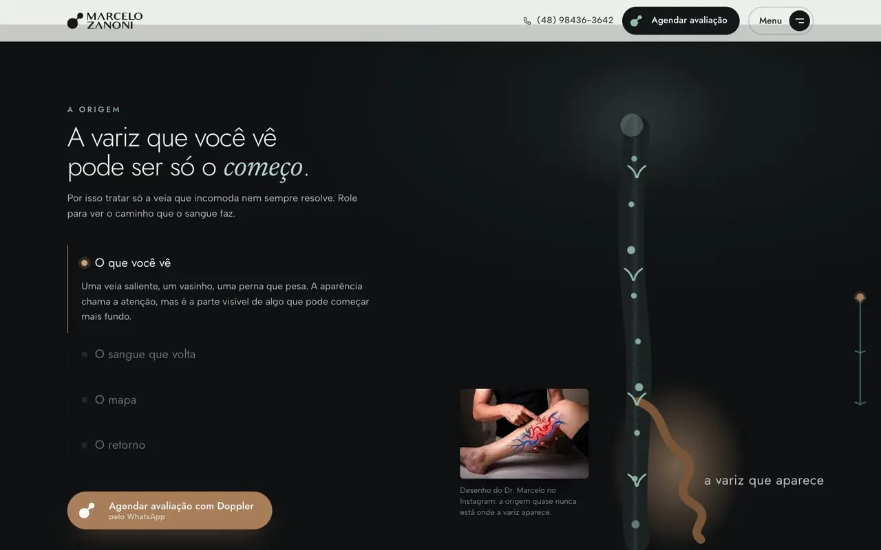 A origem da variz, contada pelo scroll, Dr. Marcelo Zanoni