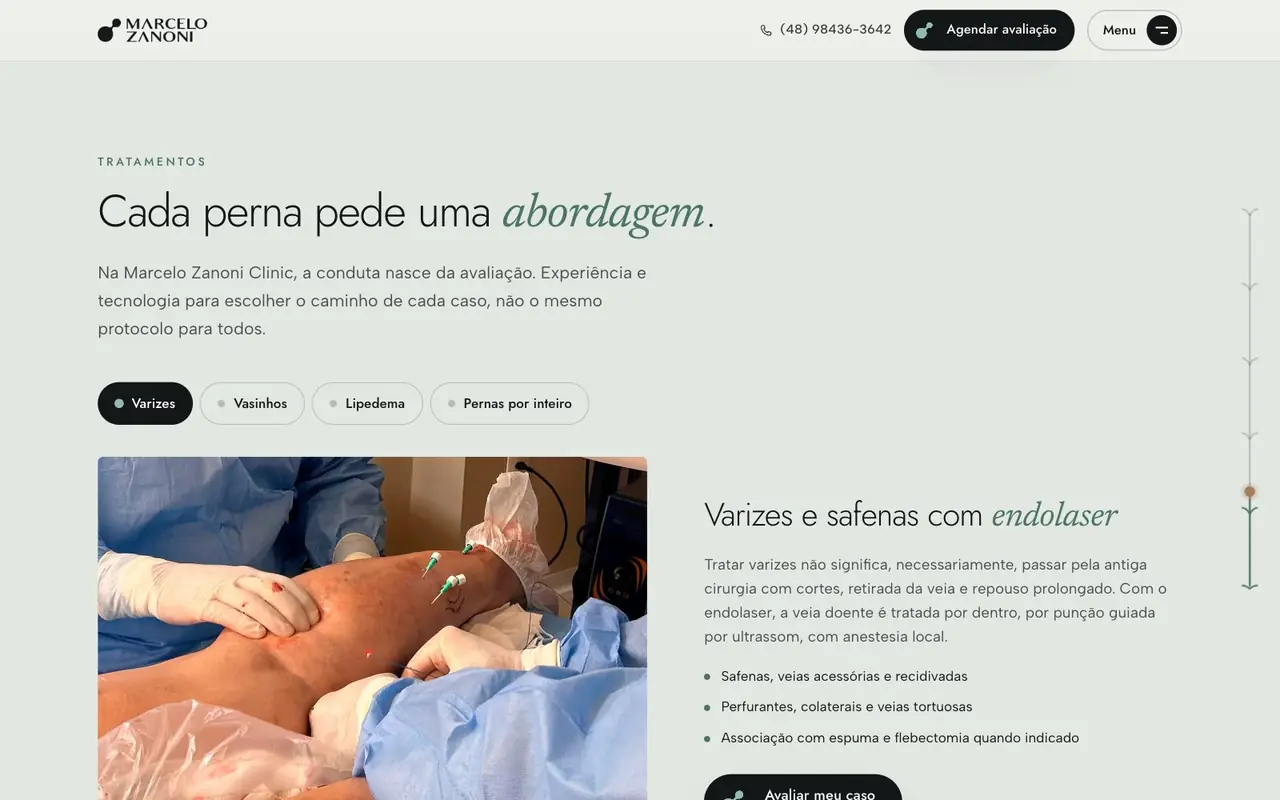 Tratamentos por tipo de caso, Dr. Marcelo Zanoni
