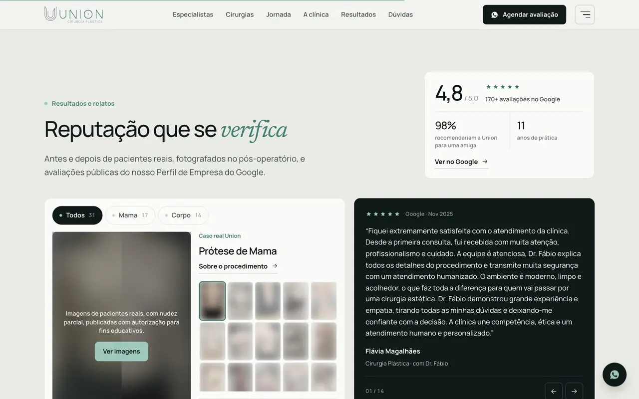 Resultados reais com aviso de consentimento, Union Cirurgia Plástica